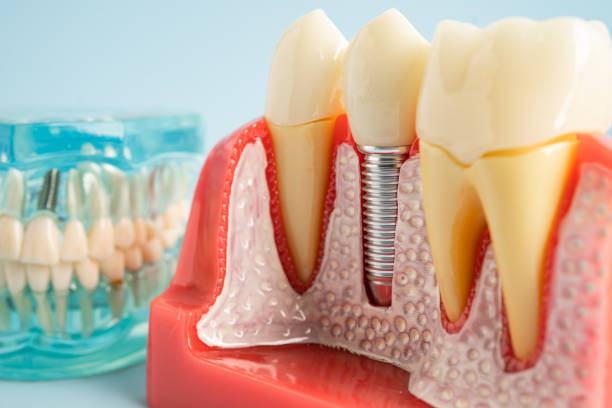 Professional  Dental Services in North Bonneville, WA